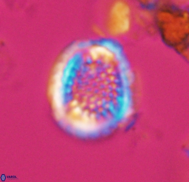 Cribrosphaerella dysmorphia 10487