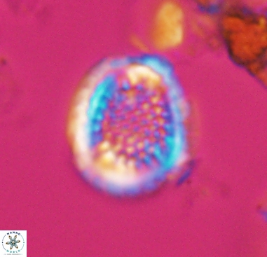 Cribrosphaerella dysmorphia 10487