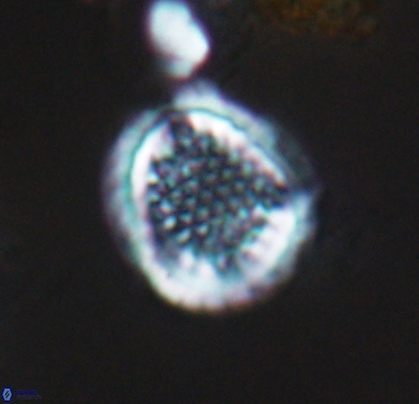 Cribrosphaerella dysmorphia 10488