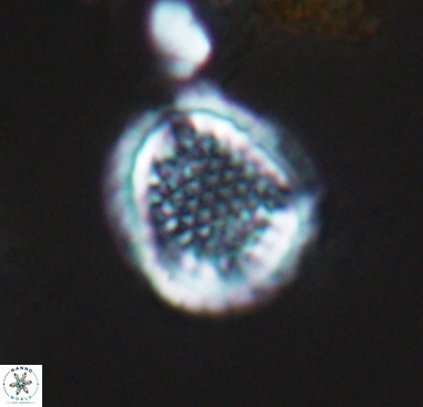 Cribrosphaerella dysmorphia 10488