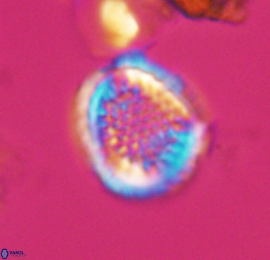 Cribrosphaerella dysmorphia 10489