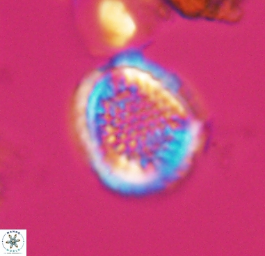 Cribrosphaerella dysmorphia 10489