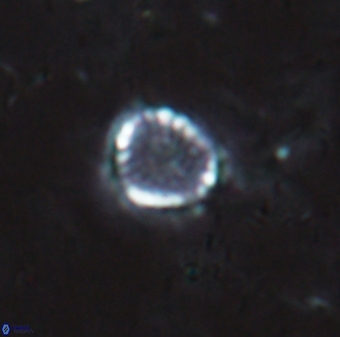 Cribrosphaerella dysmorphia 1706