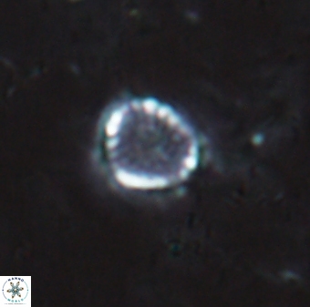 Cribrosphaerella dysmorphia 1706
