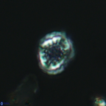 Cribrosphaerella dysmorphia 3058