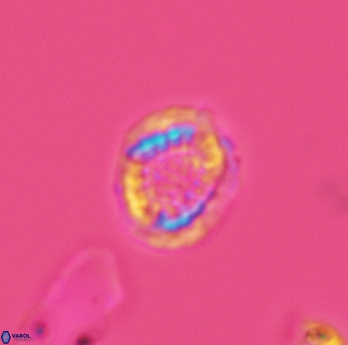 Cribrosphaerella dysmorphia 3059