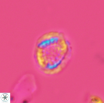 Cribrosphaerella dysmorphia 3059
