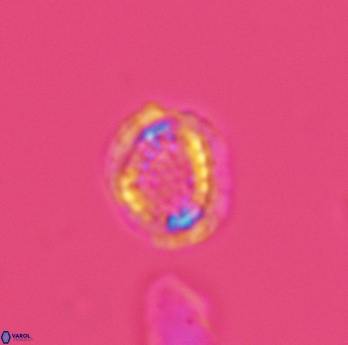 Cribrosphaerella dysmorphia 3060
