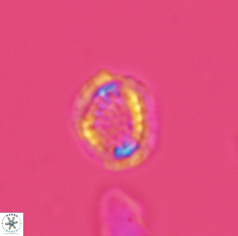 Cribrosphaerella dysmorphia 3060