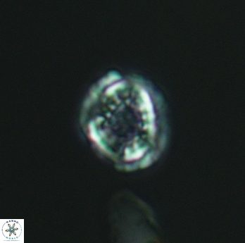 Cribrosphaerella dysmorphia 3061