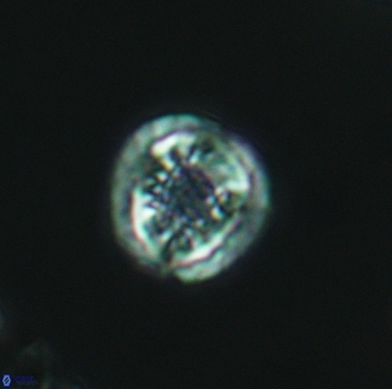 Cribrosphaerella dysmorphia 3160