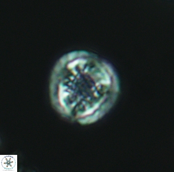Cribrosphaerella dysmorphia 3160