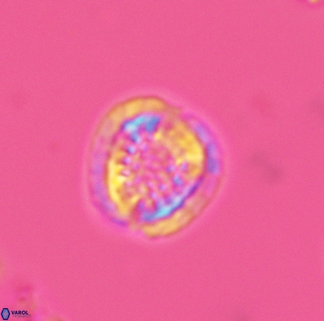 Cribrosphaerella dysmorphia 3161