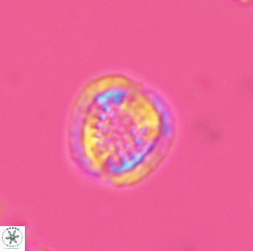 Cribrosphaerella dysmorphia 3161