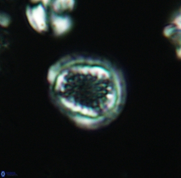 Cribrosphaerella dysmorphia 3294