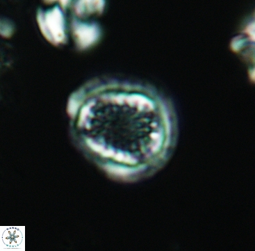 Cribrosphaerella dysmorphia 3294
