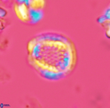 Cribrosphaerella dysmorphia 3295