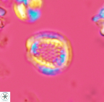 Cribrosphaerella dysmorphia 3295