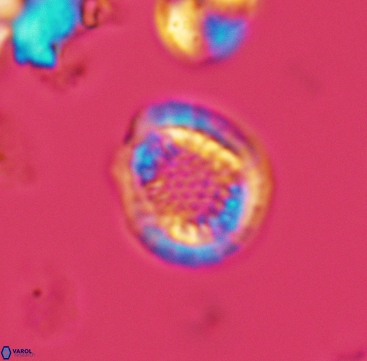 Cribrosphaerella dysmorphia 3296
