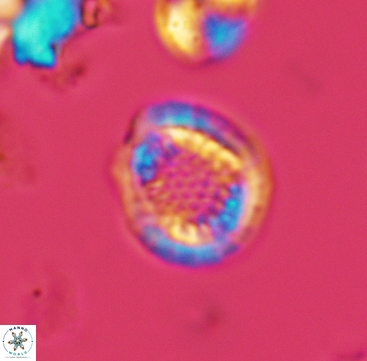 Cribrosphaerella dysmorphia 3296