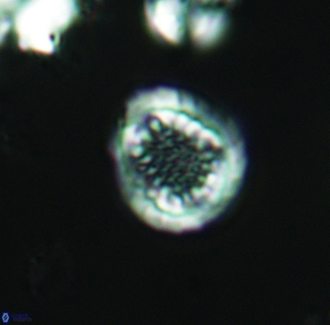 Cribrosphaerella dysmorphia 3297