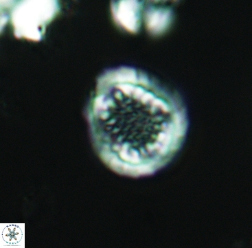 Cribrosphaerella dysmorphia 3297