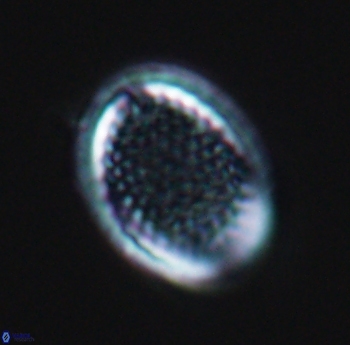 Cribrosphaerella ehrenbergii 10184