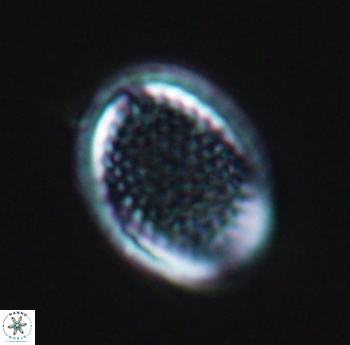 Cribrosphaerella ehrenbergii 10184