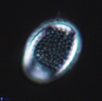 Cribrosphaerella ehrenbergii 10188