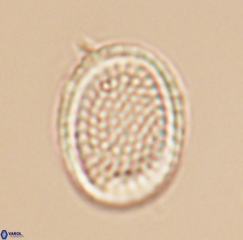 Cribrosphaerella ehrenbergii 10190