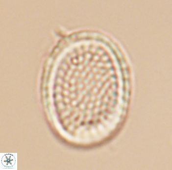 Cribrosphaerella ehrenbergii 10190