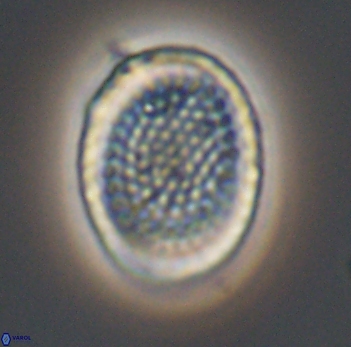 Cribrosphaerella ehrenbergii 10191