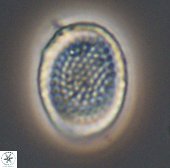 Cribrosphaerella ehrenbergii 10191