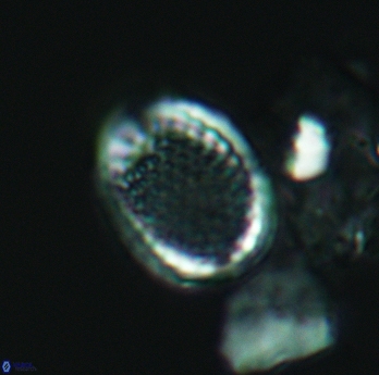 Cribrosphaerella ehrenbergii 3066