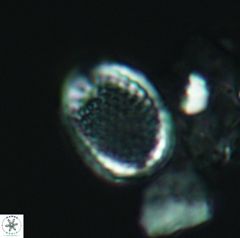 Cribrosphaerella ehrenbergii 3066