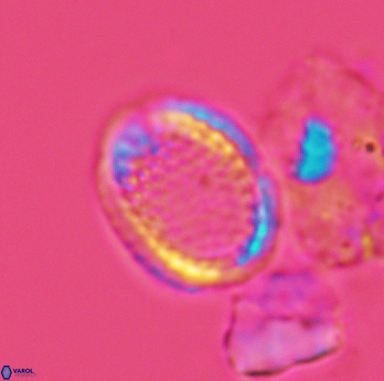 Cribrosphaerella ehrenbergii 3067