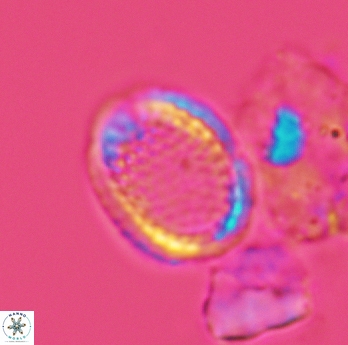 Cribrosphaerella ehrenbergii 3067
