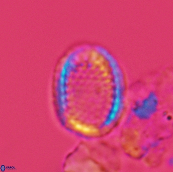 Cribrosphaerella ehrenbergii 3068