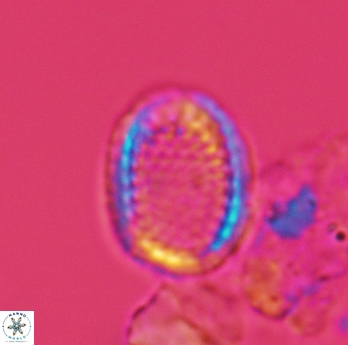 Cribrosphaerella ehrenbergii 3068