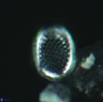 Cribrosphaerella ehrenbergii 3069