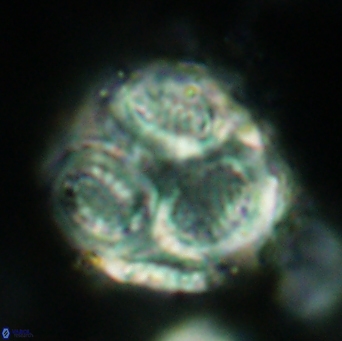 Cribrosphaerella ehrenbergii 4701