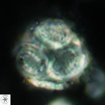 Cribrosphaerella ehrenbergii 4701