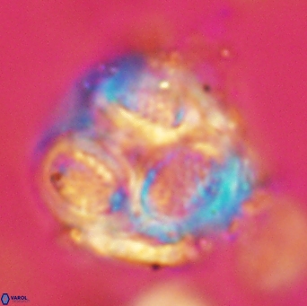 Cribrosphaerella ehrenbergii 4702