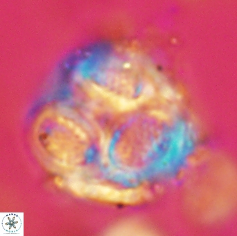 Cribrosphaerella ehrenbergii 4702