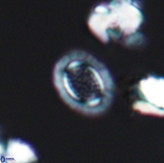 Cribrosphaerella ehrenbergii 8615