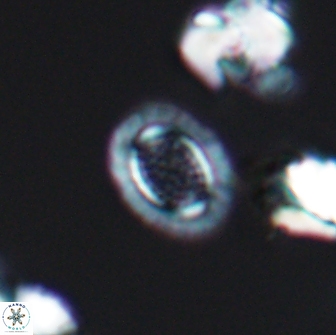 Cribrosphaerella ehrenbergii 8615