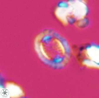 Cribrosphaerella ehrenbergii 8616