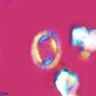 Cribrosphaerella ehrenbergii 8617