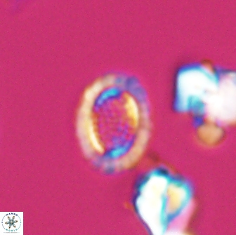Cribrosphaerella ehrenbergii 8617
