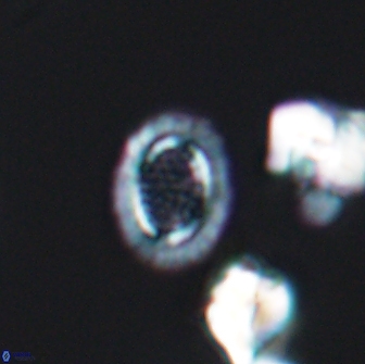 Cribrosphaerella ehrenbergii 8618